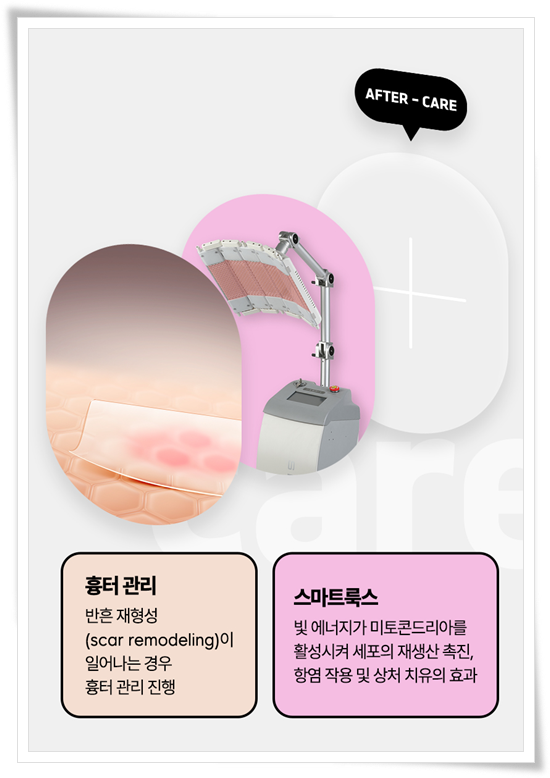 멘토 부스트 가격(비용) 촉감 후기 기준을 세우는법 관련 이미지 18