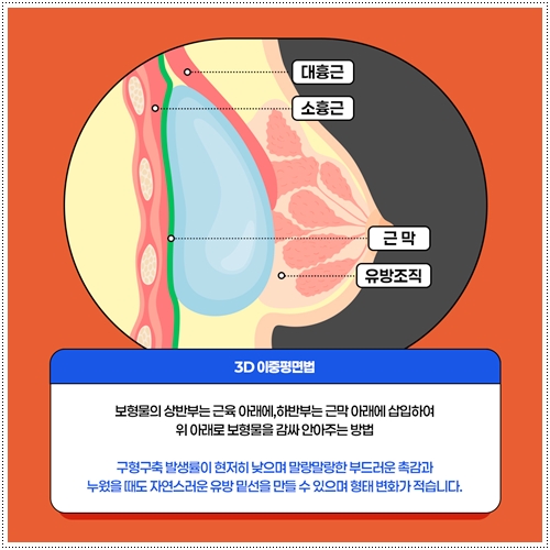 How much does breast ptosis surgery cost, and why do prices differ? image 11