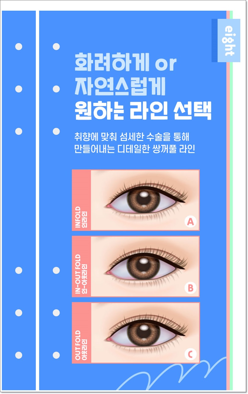 What Are the Criteria for Finding a Good Eye Surgery Clinic? image 2