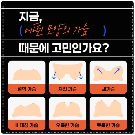 모티바 가슴수술 비용, 촉감, 후기 회복기간 특징에 대해서 관련 이미지 16