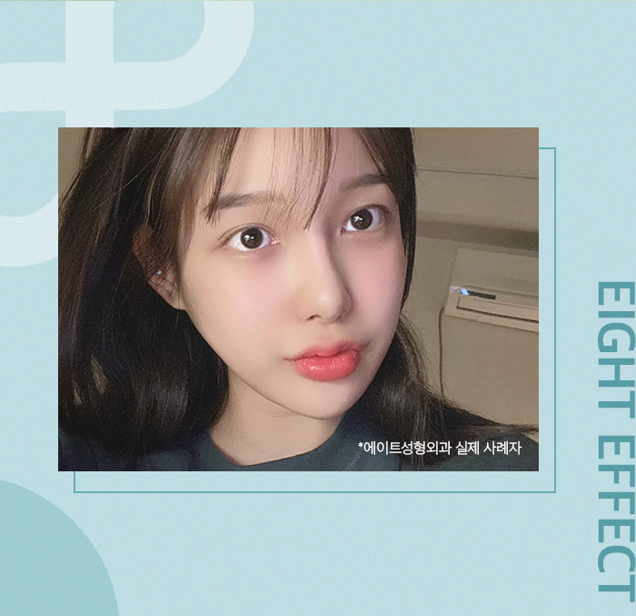 처진가슴교정 밸런스와 탄력을 함께 고려해 관련 이미지 7