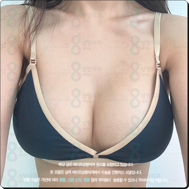 Breast Augmentation Surgery Cost (Price) and the Secret to a Review with No Side Effects Before and After? image 1