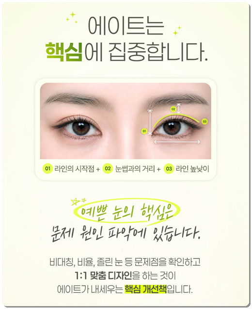 How Much Does Non-Incisional Double-Eyelid Surgery Cost? Comparing Suture and Incisional Methods image 6
