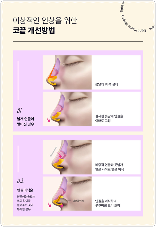What Is Important When Looking Into the Cost of Hump Nose Surgery and Correction Reviews? image 16