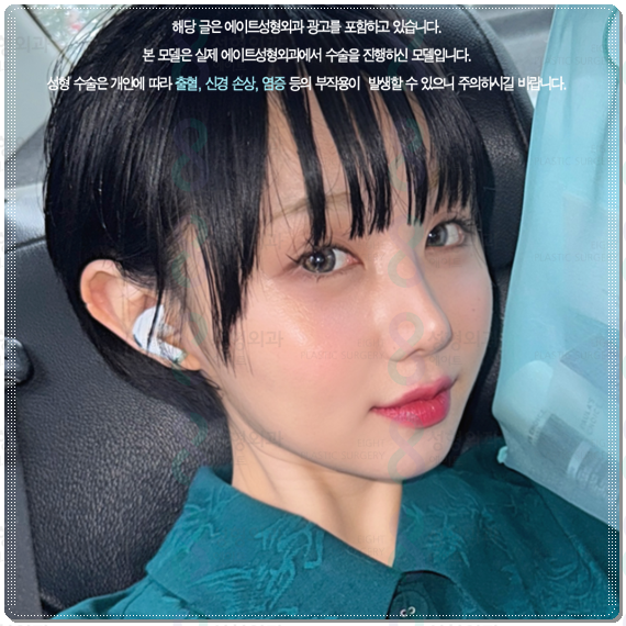 A No-Fail Guide to Comparing Rhinoplasty Costs: Recovery Period Management and Shared Reviews of Rhinoplasty Surgery image 4