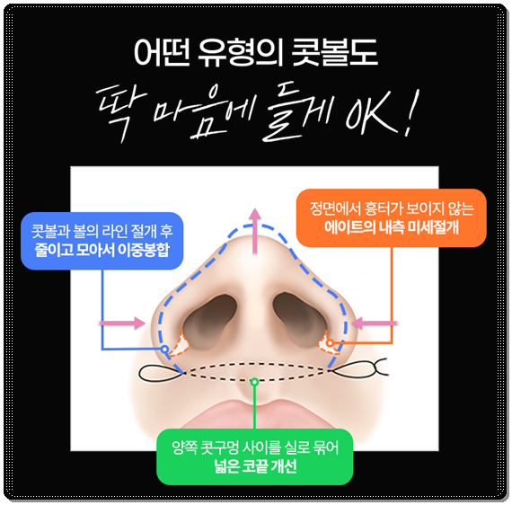 Bokko Rhinoplasty Review Summary! In Sinsa-dong, what are the costs of bokko surgery and the criteria for choosing a good clinic? image 19