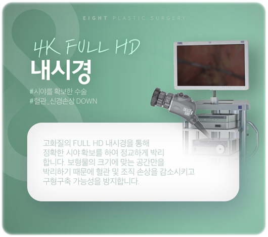 멘토엑스트라 장점, 가슴성형 부작용 (구형구축 리플링) 예방 후기 관련 이미지 19