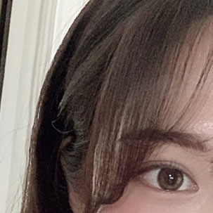 눈성형외과 내게 맞는 눈성형을 찾아요 관련 이미지 17