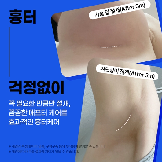 How much does breast ptosis surgery cost? image 11