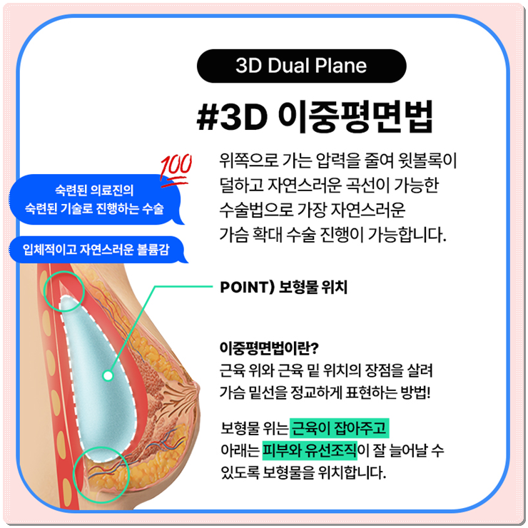세빈 보형물 : 서브리미티? 인테그리티? 특징 비교분석 관련 이미지 5