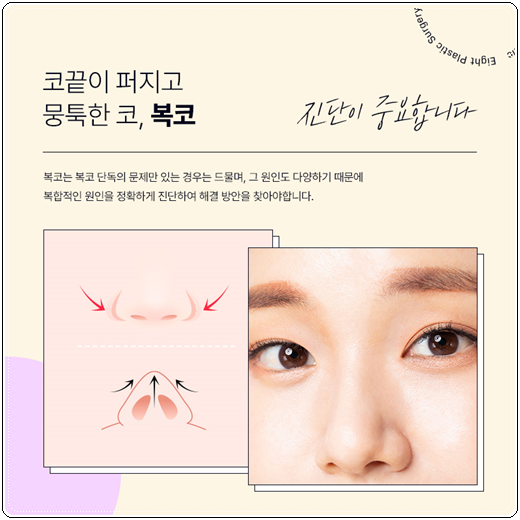 What Is Important When Looking Into the Cost of Hump Nose Surgery and Correction Reviews? image 13