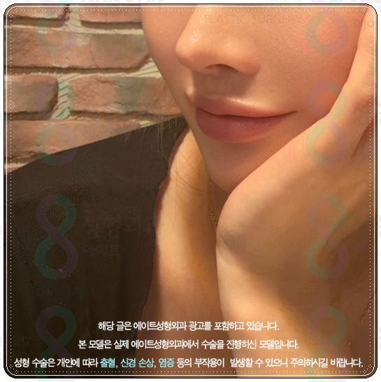 How to Choose a Clinic and Check Prices When Looking into Ulthera in Apgujeong image 1