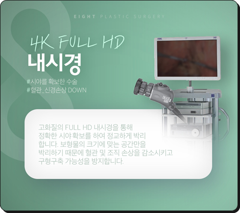 가슴보형물 종류 장단점, 가슴확대수술전후 후기 찾아보실때 관련 이미지 15