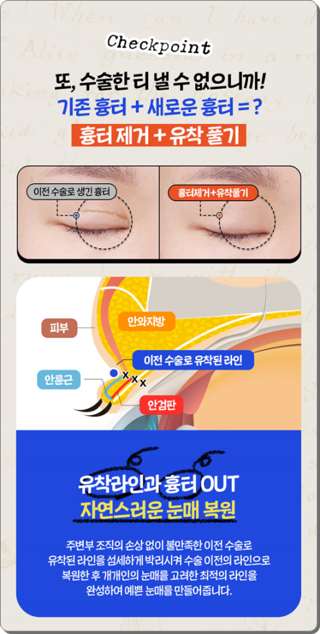 실패 없는 쌍꺼풀 재수술을 위해: 매몰법 특징부터 비용, 시기별 붓기 회복 과정 관련 이미지 16