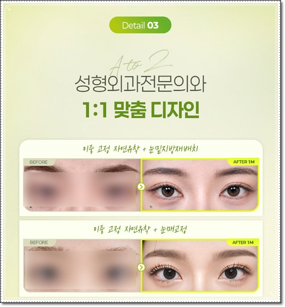 쌍커플스타일, 아웃라인과 세미아웃라인에 대해서 관련 이미지 12