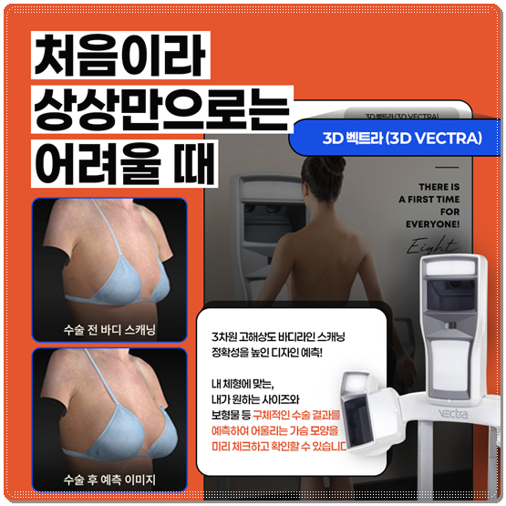 멘토 엑스트라 하이 타입? 스무스 차이, 부스트까지 비교해보면 비용은 어느 정도일까 관련 이미지 10