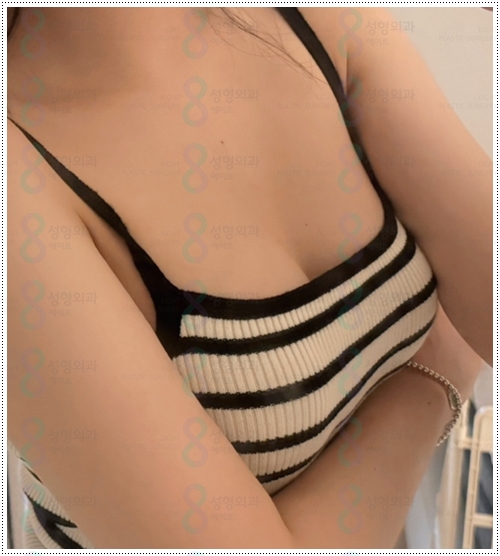 How much does breast ptosis surgery cost, and why do prices differ? image 2