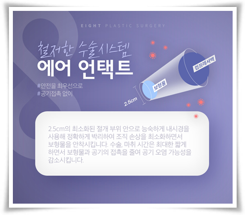모티바 가슴수술 가격? 수술 후 촉감, 구형구축 문제없나요? 관련 이미지 11