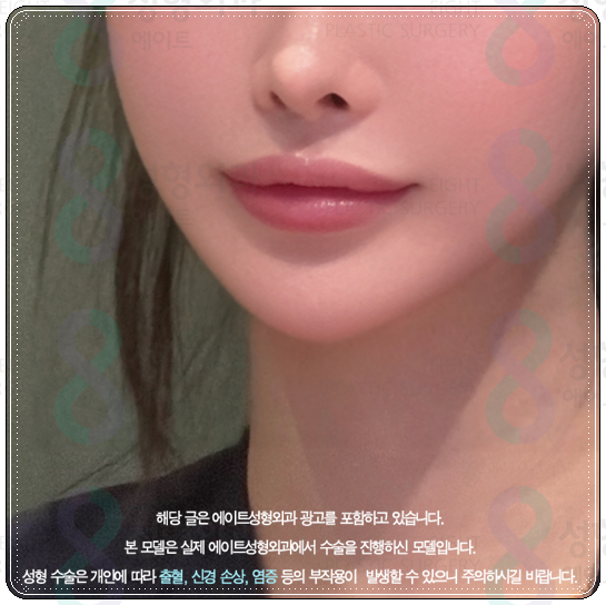 How to Choose a Clinic and Check Prices When Looking into Ulthera in Apgujeong image 4