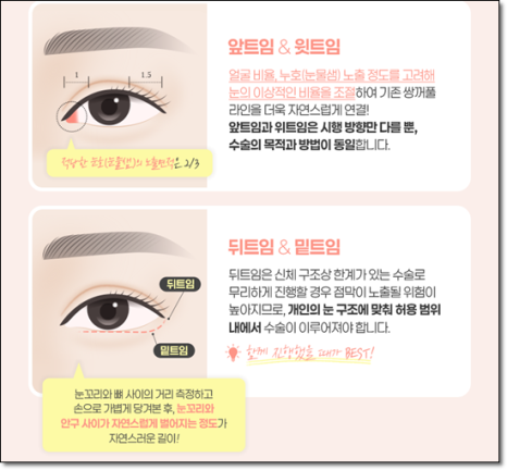 A Review of Upper Blepharoplasty Costs That Was Worth Every Penny! From How to Remove Mongolian Folds to Pricing and Recovery Care Tips image 12