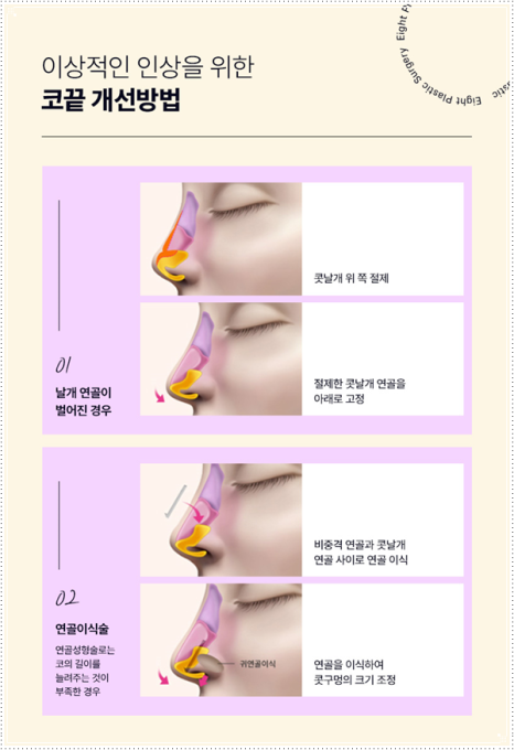 여자와 남자의 코성형 수술 차이점과 비용, 보형물 선택 가이드 관련 이미지 11
