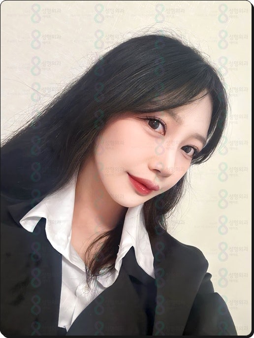 If You Have Been Looking Into Outer Corner and Lower Corner Eye Surgery Reviews, and Eye Corner Surgery Prices image 5