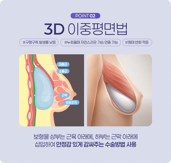 Apgujeong Plastic Surgery Clinics: Sharing Information on Breast Augmentation and Motiva Surgery image 10