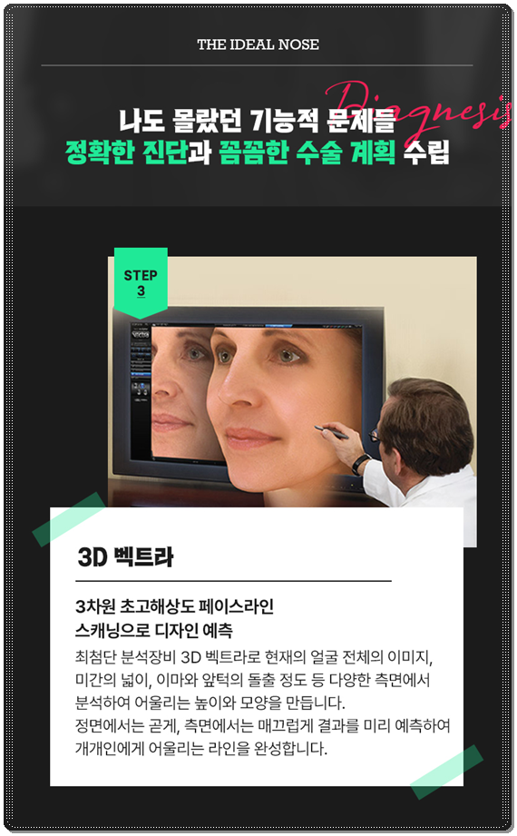 Bokko Rhinoplasty Review Summary! In Sinsa-dong, what are the costs of bokko surgery and the criteria for choosing a good clinic? image 14