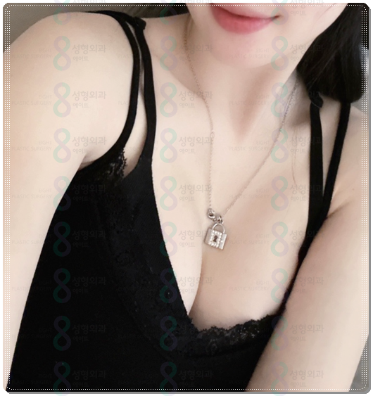 모티바 가슴수술 비용, 촉감, 후기 회복기간 특징에 대해서 관련 이미지 6