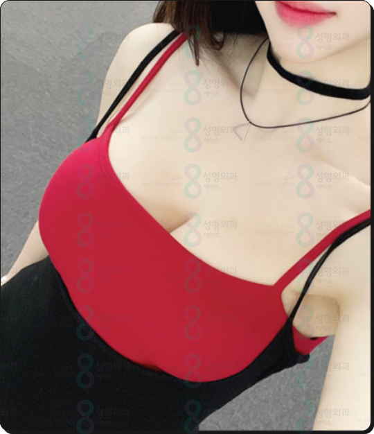가슴확대수술비용 어떻게 비교하나요? 관련 이미지 4