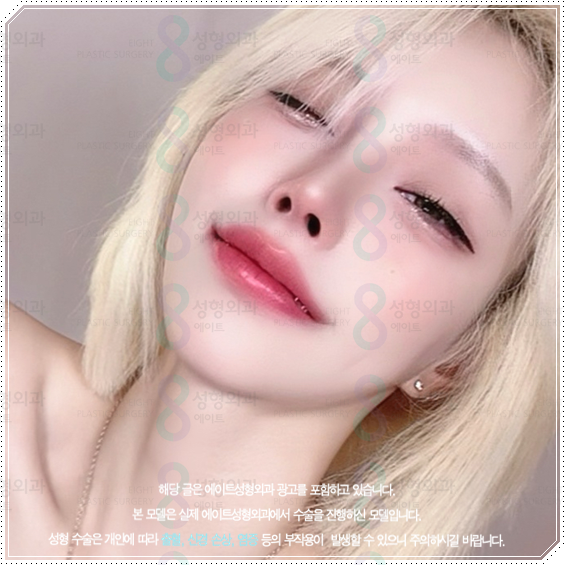 How Much Does a Non-Implant Tip Rhinoplasty Cost? Types of Materials Used in Nose Surgery and How It Differs from Bridge Surgery image 3
