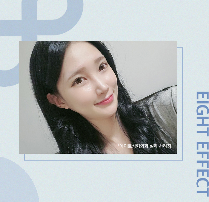 안면윤곽비용 아깝지않는 결정을 위해 관련 이미지 6