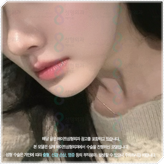 울쎄라피프라임 효과 얼마나 갈까? 300샷 통증과 후기, 가격까지 관련 이미지 1