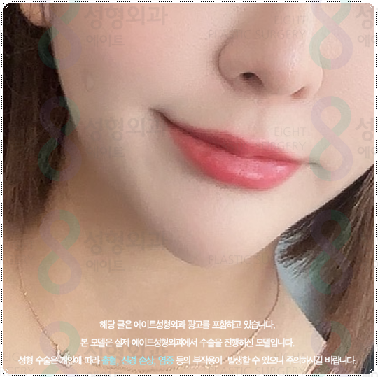 When You’re Unsure About the Difference Between 300 and 600 Ulthera Shots, Here’s What Matters More Than Cost image 5