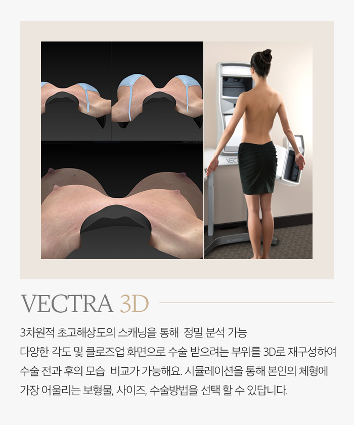 멘토보형물 A to Z 관련 이미지 4