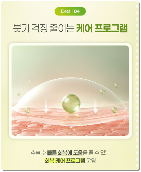 수술 가격이 다른 이유? 매몰과 절개 어떤 쌍꺼풀 재수술을 해야할까? 관련 이미지 14