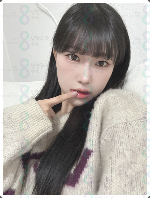 매부리코수술 비용, 왜 병원마다 차이가 날까? 관련 이미지 2