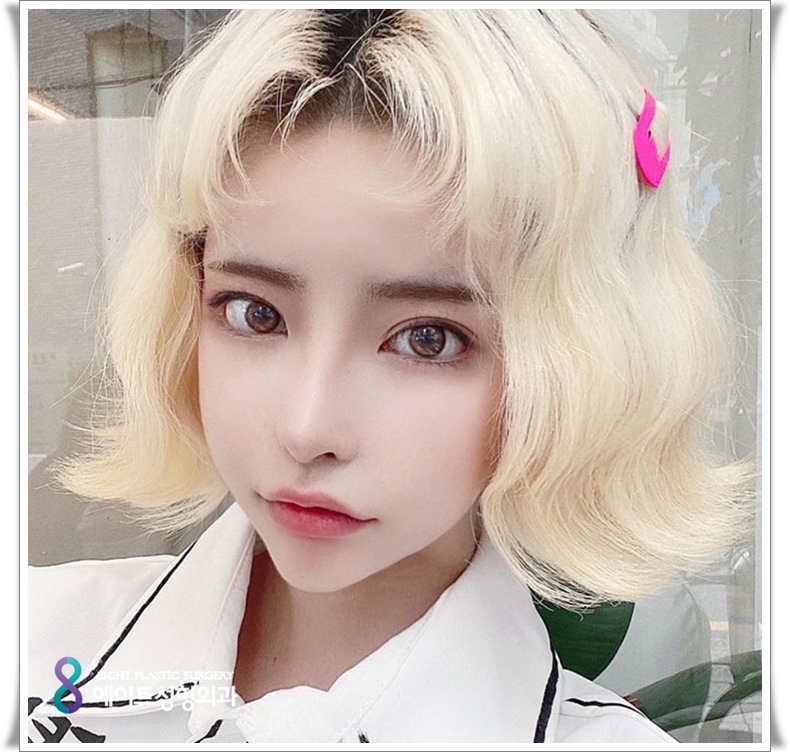자연유착 쌍꺼풀 가격 확인해볼까요? 관련 이미지 1