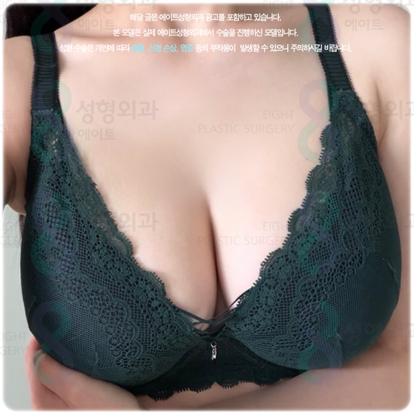 가슴확대수술, 후기와 비용·붓기·회복 기간은 어떻게 될까? 관련 이미지 4