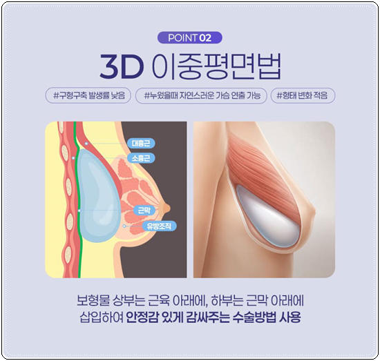 How Much Does Breast Augmentation with Mentor Xtra Cost? What to Know About Feel and Precautions Before and After Surgery image 13