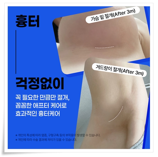 How much does breast augmentation surgery cost? image 7