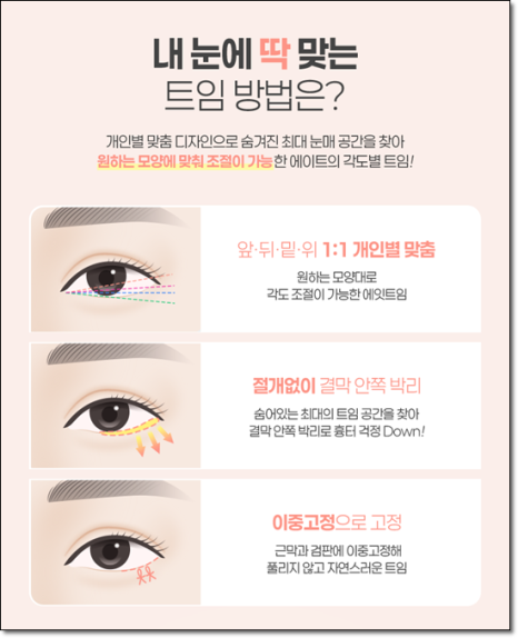 A Review of Upper Blepharoplasty Costs That Was Worth Every Penny! From How to Remove Mongolian Folds to Pricing and Recovery Care Tips image 10