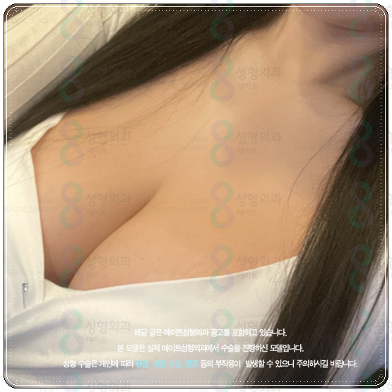 처진가슴수술 비용 (가격), 처짐 개선 방법은? 후기, 회복기간 어떤가요? 관련 이미지 4