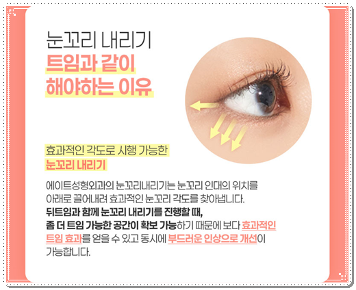 보통 자연유착과 밑트임을 같이하면 붓기는 언제 빠질까요? 관련 이미지 9