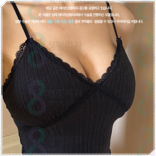 가슴성형으로 예쁜 가슴을 만들려면? 모티바 멘토 바운스 보형물에 대해 관련 이미지 5