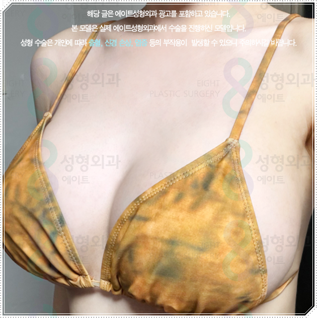 Why Do Breast Augmentation Surgery Prices Differ by Type, and How Can You Avoid Side Effects? image 1