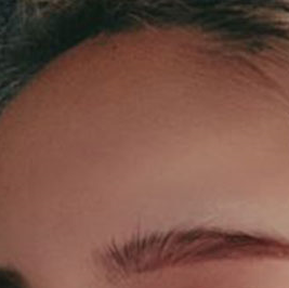 Why Facial Proportions Matter for a Straight-But-Slightly-Upturned Nose image 13