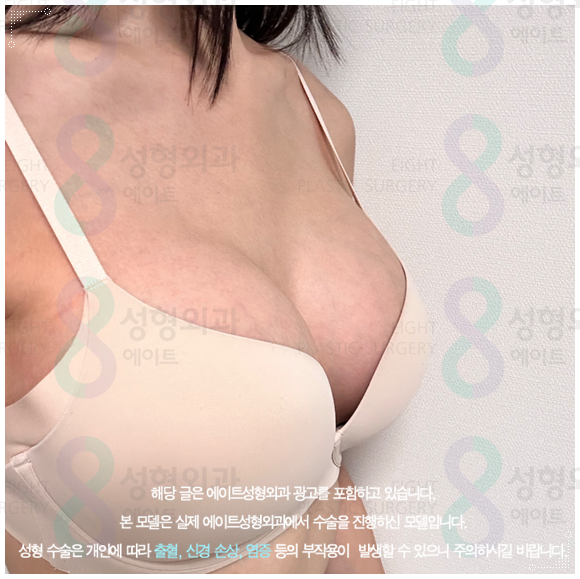 모티바 보형물이 가슴 수술의 가격 차이가 나는 이유? (부작용 증상을 낮추는법) 관련 이미지 4