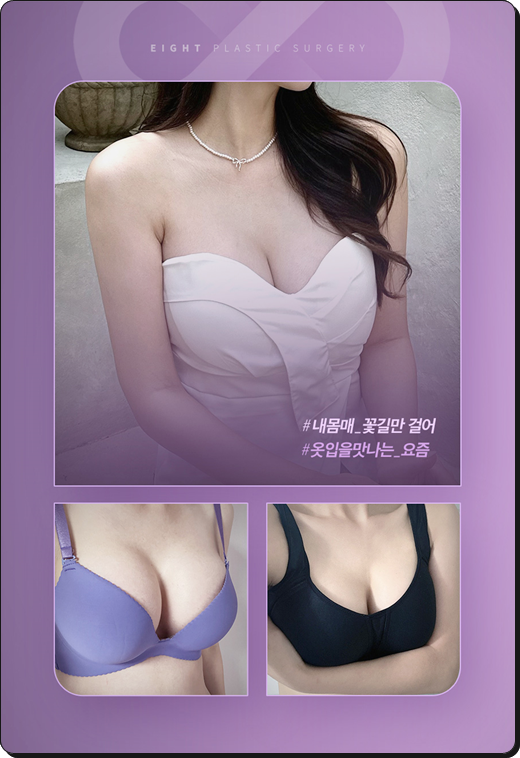 Breast Augmentation Types and Methods, Implant Costs, Pros and Cons image 28