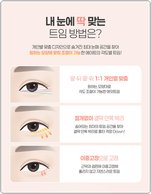 쌍커풀 하고 앞트임 수술을 해도될까? 쌍수 이후 라인 변화에 대해서 관련 이미지 7